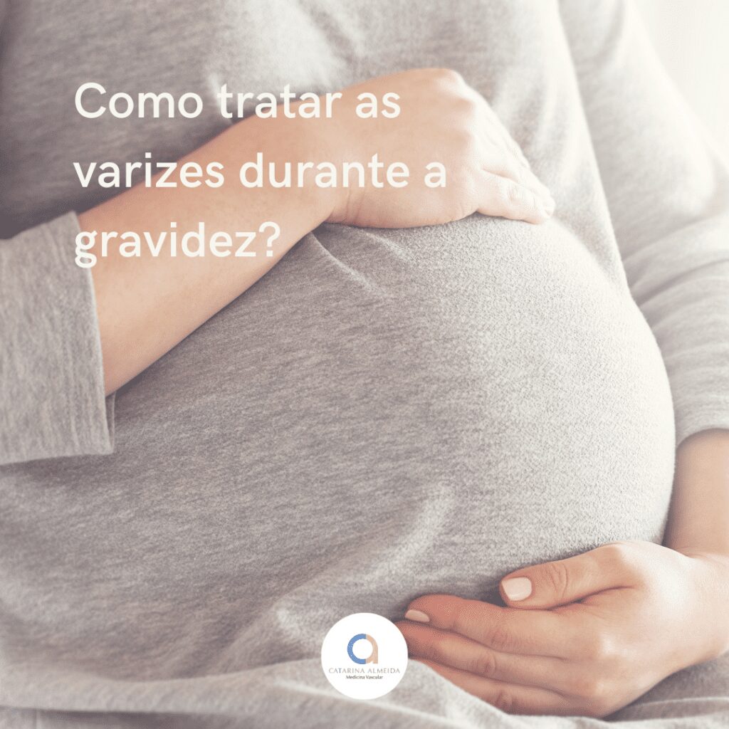 Como Tratar As Varizes Durante A Gravidez Dra Catarina Almeida